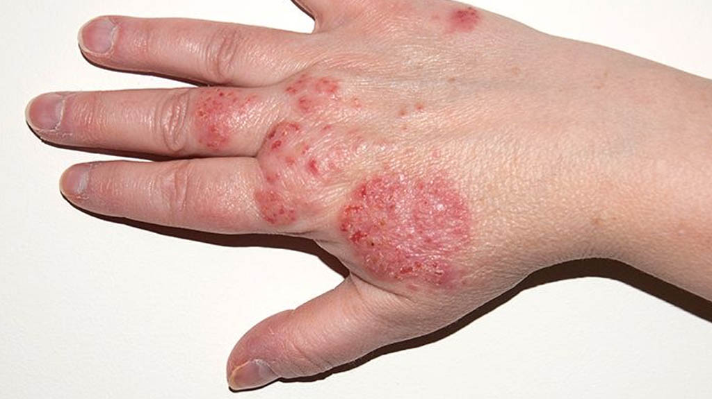 Clinical Dermatology