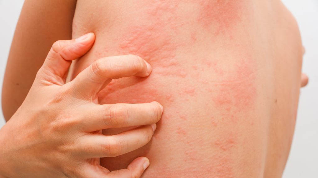 Clinical Dermatology