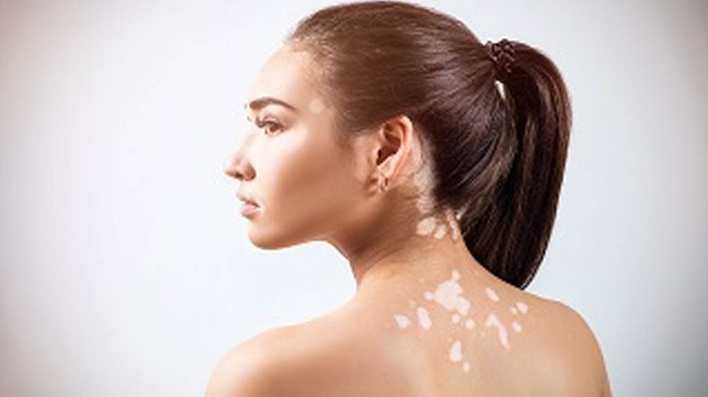 Clinical Dermatology