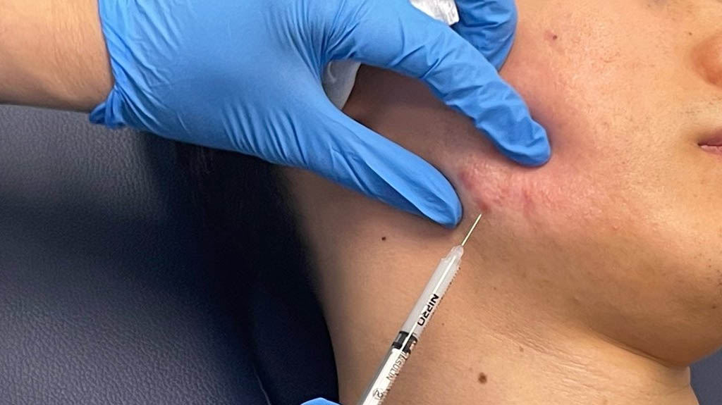 Dermatology