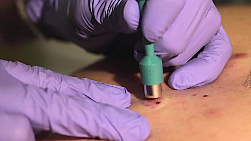 Dermatology