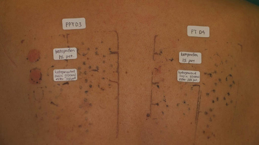 Dermatology