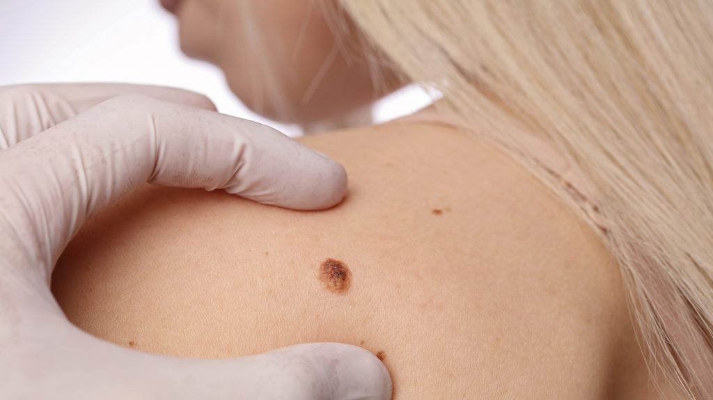 Dermatology
